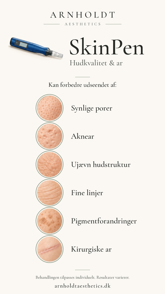 SkinPen forbedrer synlige porer, akne-ar, hudstruktur, fine linjer, pigmentforandringer og kirurgiske ar